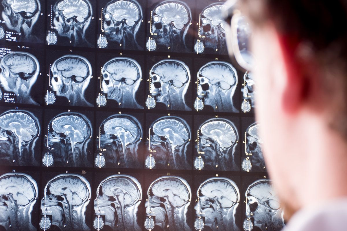 MRI scan of head and brain. Doctor in foreground with blurred silhouette looks at magnetic resonance imaging of brain of patient in background in focus.
